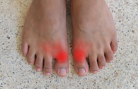 gout pain in foot